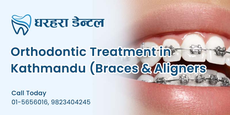 Orthodontic Treatment in Kathmandu (Braces & Aligners