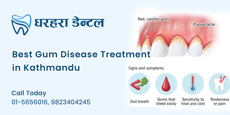Best Gum Disease Treatment in Kathmandu