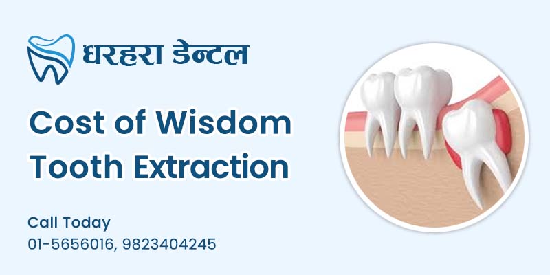 cost of wisdom tooth extraction