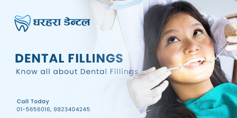 Dental Fillings