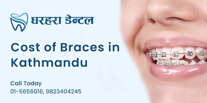 cost of dental braces